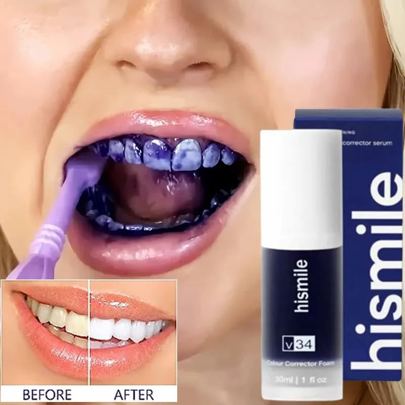 Whitening Toothpaste Kit without Toothbrush Pen Strips