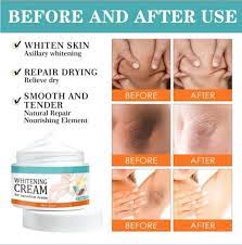 Whitening cream for Private part