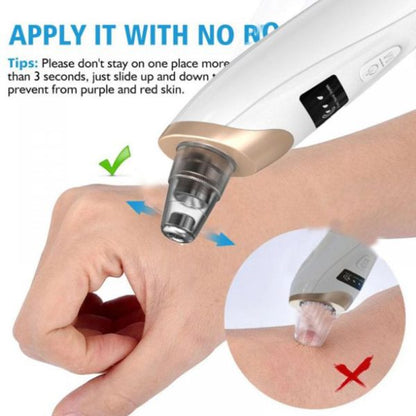 Blackhead Removal Machine Derma Suction 5 In 1